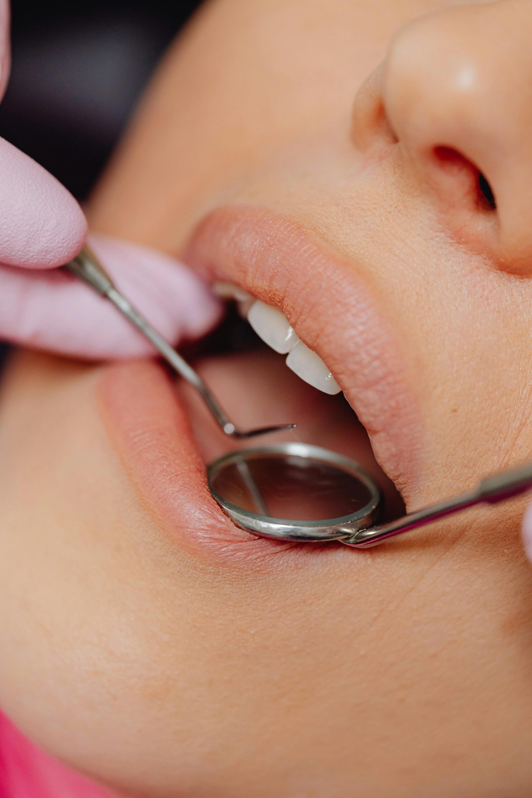 Finding Best Dentist in Frisco tx
