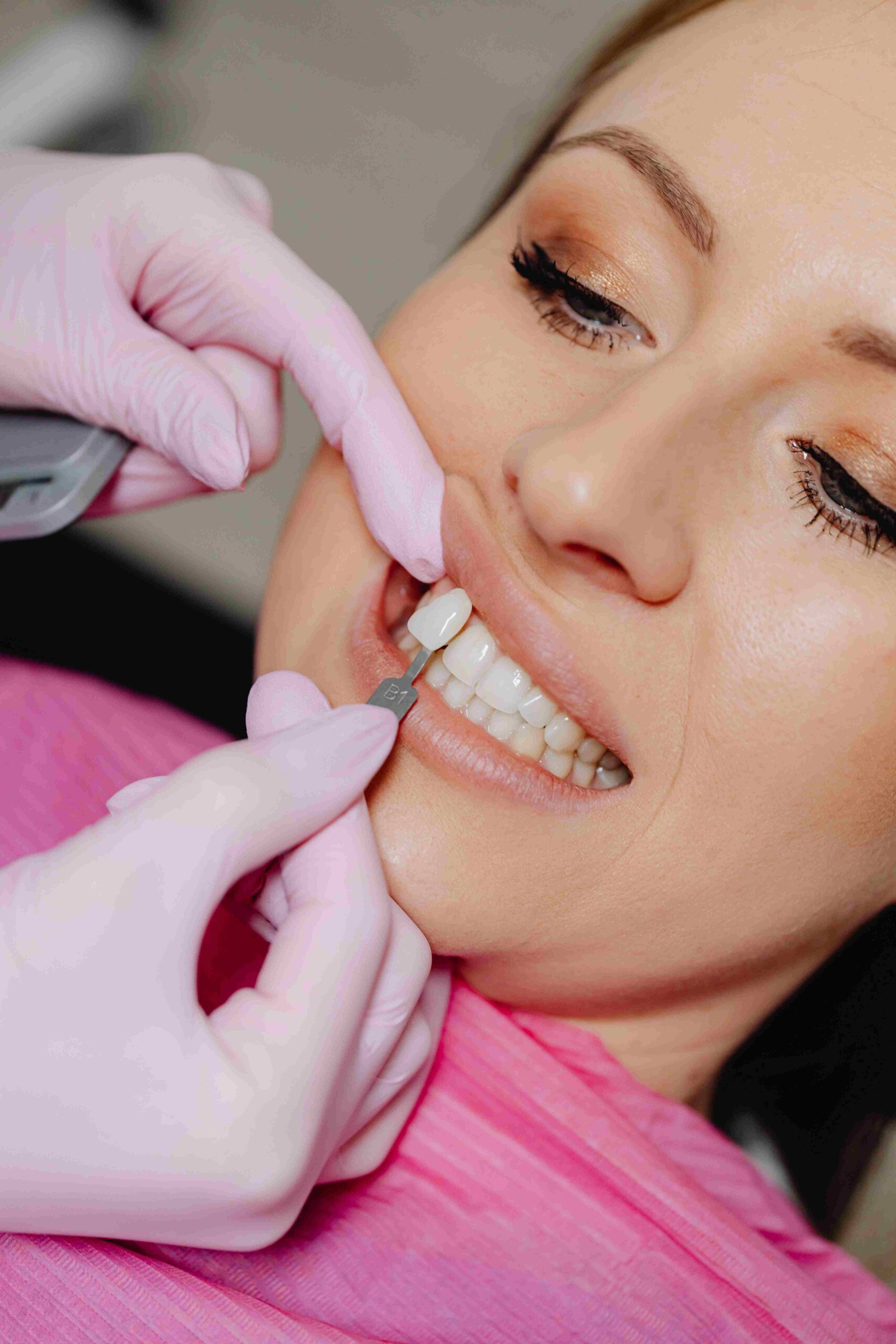 Pop-On Veneers 2025: Are They Worth It or Bad for Your Teeth?